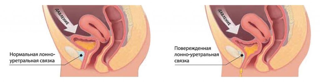 Откуда выходит моча у женщин схема